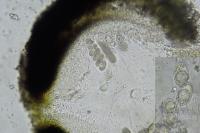 Verrucaria muralis