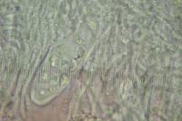 Gyalolechia flavorubescens