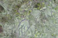 Arthonia didyma
