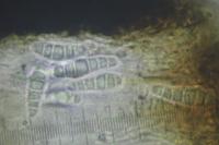 Alyxoria varia