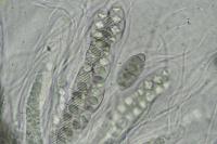 Pyrenula chlorospila