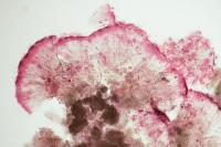 Protoblastenia rupestris
