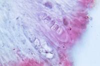 Protoblastenia rupestris