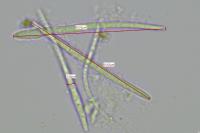 Bacidia fraxinea