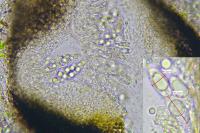 Bagliettoa parmigera