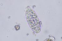 Polyblastia cupularis