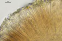Lecania turicensis