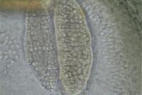 Agonimia tristicula