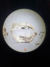 Microtus agrestis