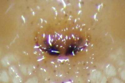 <i>Tibellus oblongus</i>