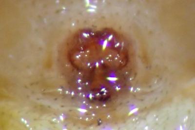 <i>Xysticus erraticus</i>