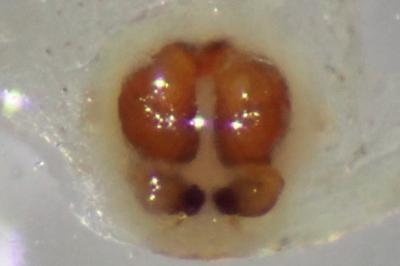 <i>Xysticus erraticus</i>