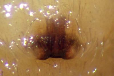 <i>Clubiona phragmitis</i>