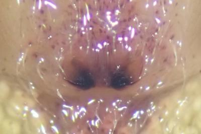 <i>Tibellus oblongus</i>
