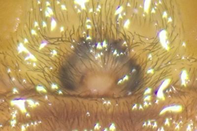 <i>Cheiracanthium punctorium</i>