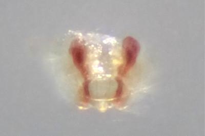 <i>Bathyphantes gracilis</i>