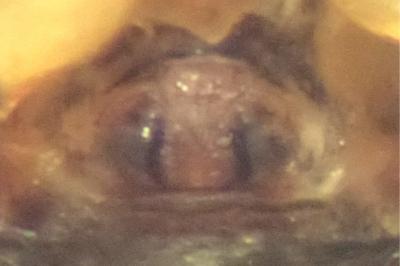 <i>Oedothorax fuscus</i>