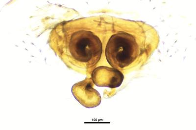 <i>Hypsosinga pygmaea</i>