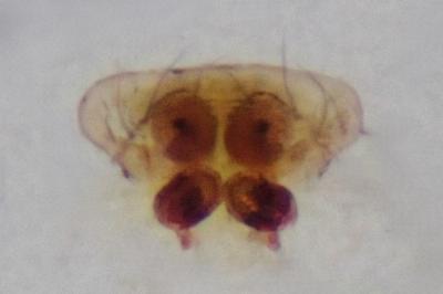 <i>Hypsosinga pygmaea</i>