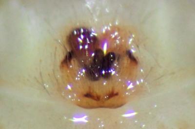 <i>Clubiona terrestris</i>