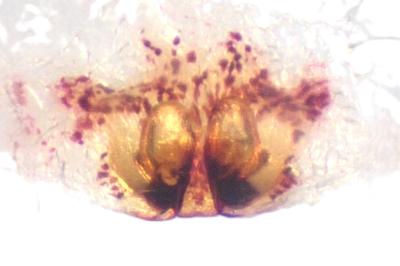 <i>Tibellus oblongus</i>