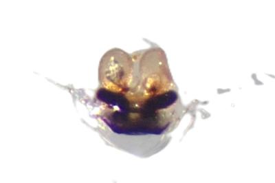 <i>Enoplognatha ovata</i>