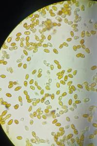 <i>Scapania nemorea</i>
