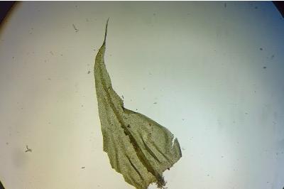 <i>Abietinella abietina</i>