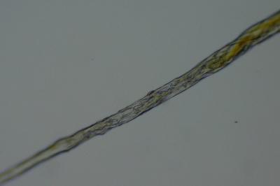 <i>Syntrichia laevipila</i>