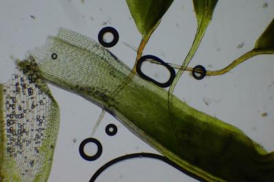 <i>Syntrichia laevipila</i>