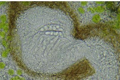 <i>Lichenochora galligena</i>