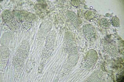 <i>Phlyctis agelaea</i>