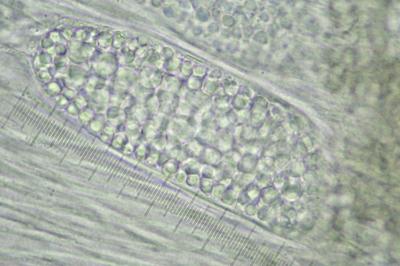 <i>Phlyctis agelaea</i>
