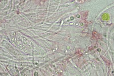<i>Athallia pyracea</i>