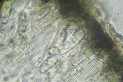 <i>Arthonia apotheciorum</i>