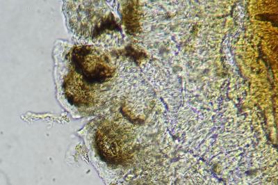 <i>Stigmidium squamariae</i>