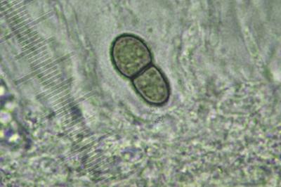 <i>Peridiothelia fuliguncta</i>