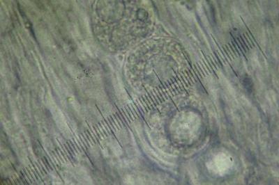 <i>Aspicilia contorta</i>