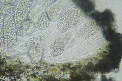 <i>Phlyctis agelaea</i>