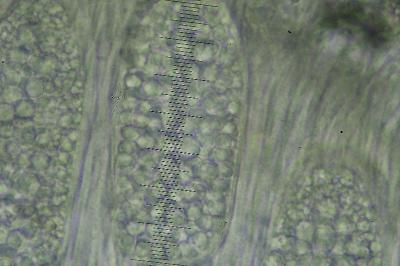 <i>Phlyctis agelaea</i>