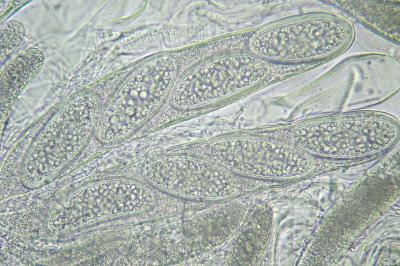 <i>Pertusaria leioplaca</i>