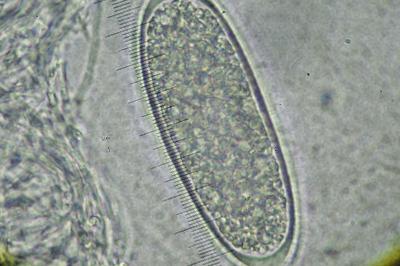 <i>Pertusaria leioplaca</i>