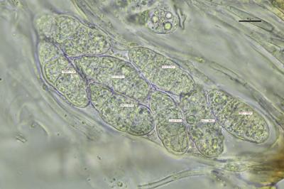 <i>Blennothallia crispa</i>