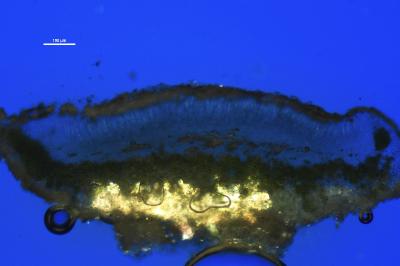 <i>Lecanora albella</i>