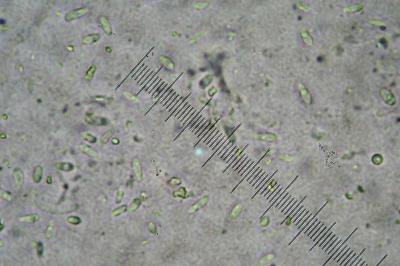 <i>Sarcogyne belarusensis</i>