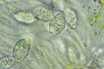 <i>Gyalecta liguriensis</i>