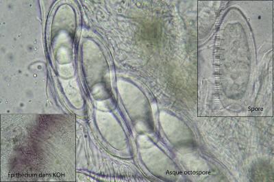 <i>Pertusaria hymenea</i>