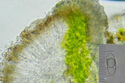 <i>Polyozosia dispersa</i>
