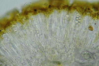 <i>Protoblastenia rupestris</i>