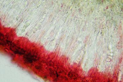 <i>Protoblastenia rupestris</i>